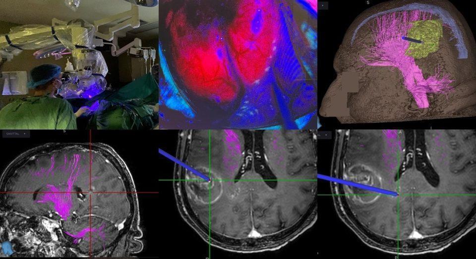 epemvasiafairesisogkou