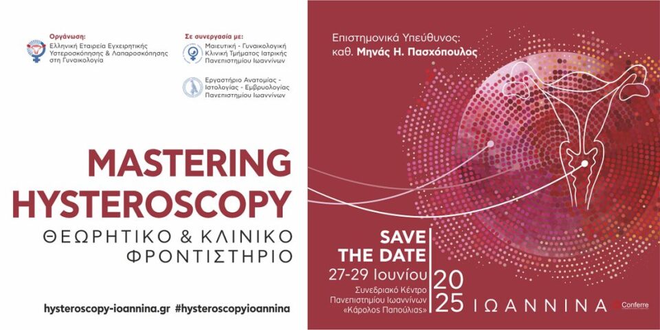hysteroscopy mastering 1